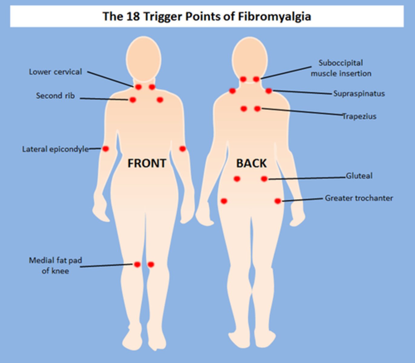 <p>chronic widespread pain in all 4 quadrants → above and below the waist, left and right sides of body, and in the axial skeleton</p><p>&gt;3 months</p>