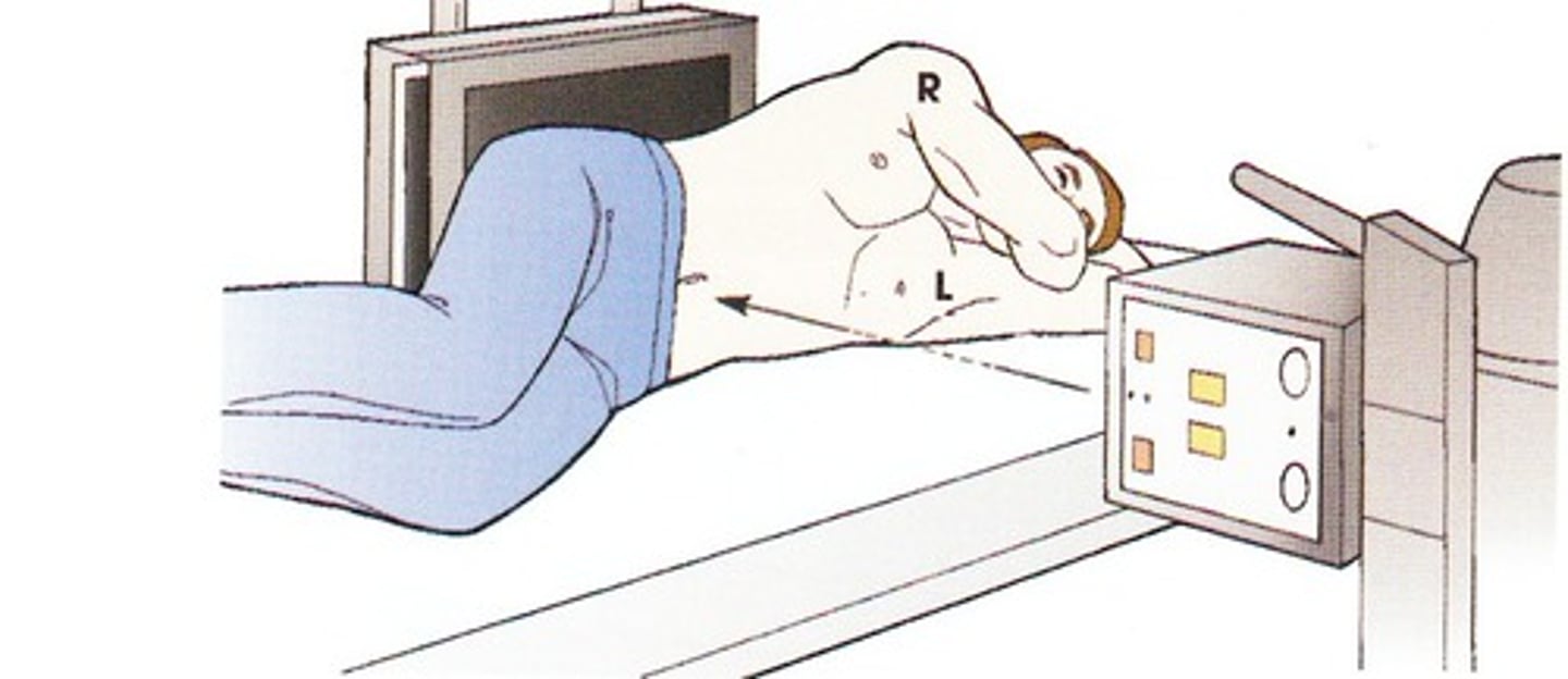 <p>lateral decubitus</p>